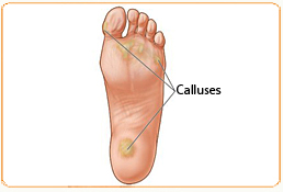 Foot care – MediComfort